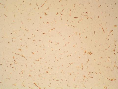 Inmunohistoquimia - <div style=